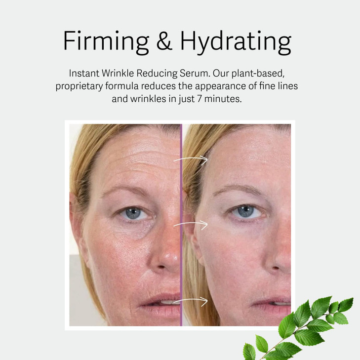 Athena 7 Minute Lift  Organic Lifting & Firming Serum  Visibly Tightens Eye, Neck & Face in 7 Minutes  Reduces Wrinkles & Fine Lines