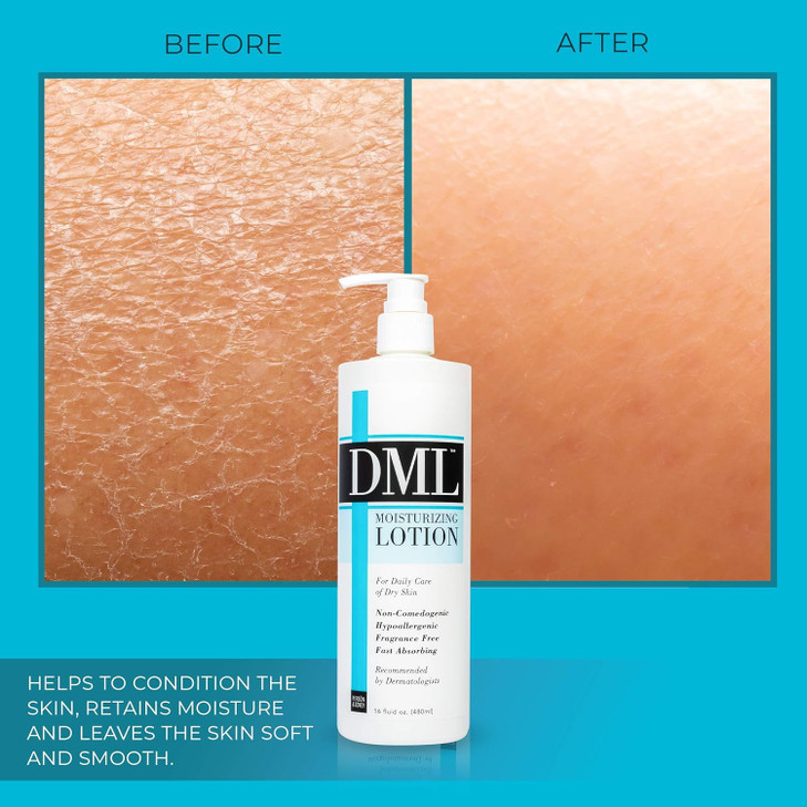 DML Moisturizing Lotion 16 oz (Pack of 5)