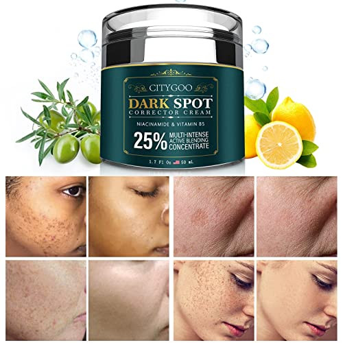 CITYGOO Dark Spot Remover for Face: Dark Spot Corrector Cream - Enriching Skin Care For All Skin Tones - Melasma Freckle Sun Spot Remover & Blemish R