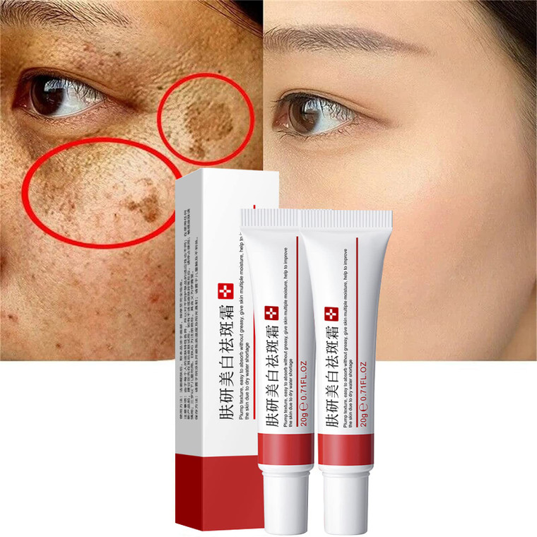 2 Pcs Whitening Freckle Cream, Acne Scar Removal Treatment Cream, Pigmentation Removal Cream for Face, Moisturizing Removes Facial Melasma Dark Spots