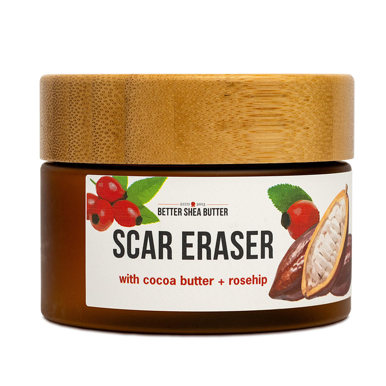 Better Shea Butter Scar Eraser Balm - Cocoa Butter Cream for Stretch Marks and Dark Spots, Burns, Old Scars - Acne Scars - Designed w Zero Synthetic