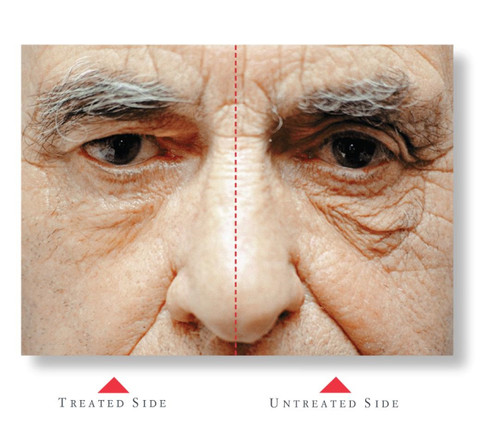 Cellex-C Advanced-C Serum 2-Step Kit | SkinElite