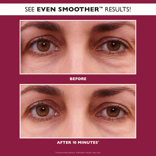 Peter Thomas Roth Even Smoother Glycolic Retinol Hydra-Gel Eye Patches - 30 pair_before and after