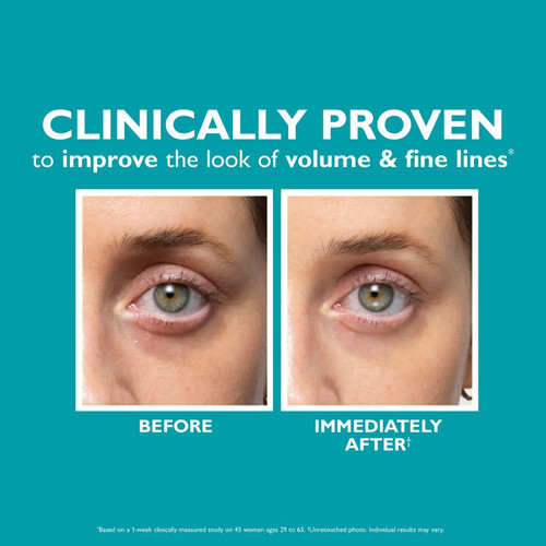 Peter Thomas Roth Peptide Skinjection Fill + Fix Under-Eye Cream 0.5 fl oz - SkinElite - before and after