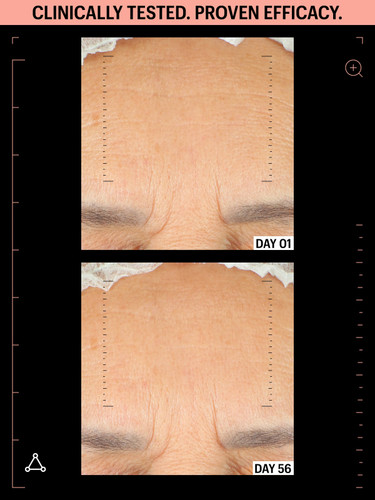 Allies of Skin Peptides & Antioxidants Advanced Firming Daily Treatment 1.6 fl oz - SkinElite - before & after 2 Allies of Skin Peptides & Antioxidants Advanced Firming Daily Treatment 1.6 fl oz - SkinElite - before & after 2