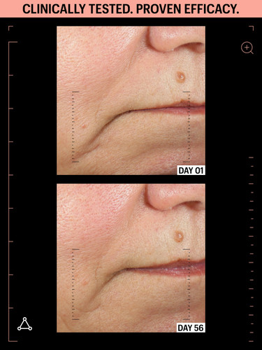 Allies of Skin Peptides & Antioxidants Advanced Firming Daily Treatment 1.6 fl oz - SkinElite - before & after 1 Allies of Skin Peptides & Antioxidants Advanced Firming Daily Treatment 1.6 fl oz - SkinElite - before & after 1