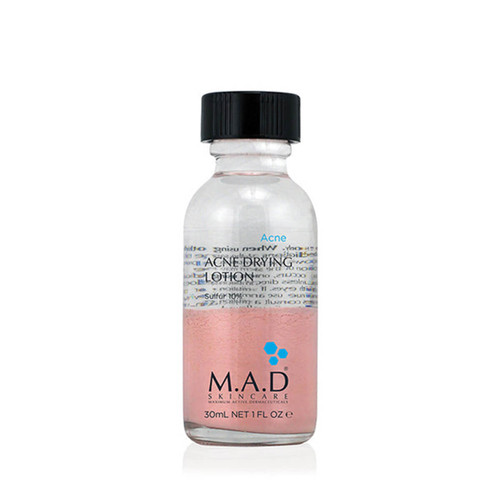 M.A.D Skincare Acne Drying Lotion with Sulfur 10% 1 fl oz - Skin Elite