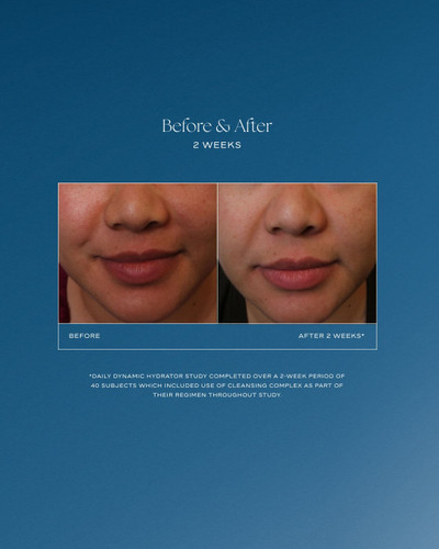 iS Clinical Daily Dynamic Hydrator 1.7 oz - Skin Elite - before and after 1