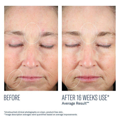 SkinBetter Science Mystro Revive Renewing Serum 1 fl oz - Skin Elite - Clinical Results SkinBetter Science Mystro Revive Renewing Serum 1 fl oz - Skin Elite - Clinical Results