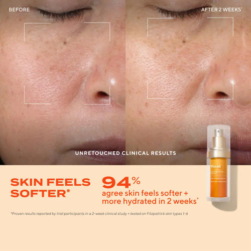 Murad Glow Better Brightening Discovery Kit before and after 1