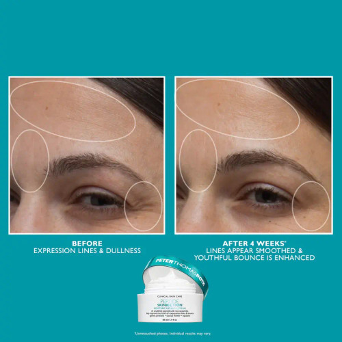 Peter Thomas Roth Full-Size Peptide Skinjection™ 2-Piece Kit Face & Eye Kit moisturizer before and after