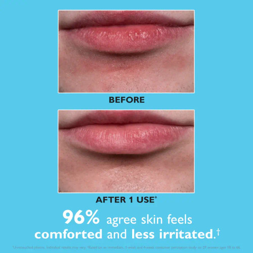 Peter Thomas Roth Water Drench® Hyaluronic Balm Barrier Cream 1.7 fl oz before and after 2