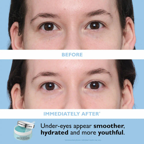 Peter Thomas Roth Full Size Drench Essentials Kit eye patch before and after