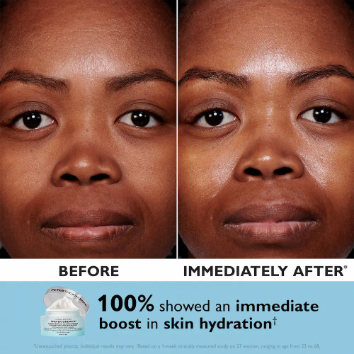 Peter Thomas Roth Full Size Drench Essentials Kit moisturizer before and after