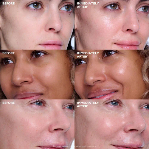 Peter Thomas Roth Collagen Skinjection Plumping & Firming Serum 1 fl oz befores and afters