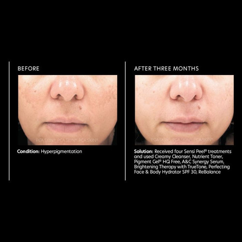 PCA Skin Pigment Gel HQ Free 1 fl oz - results 1