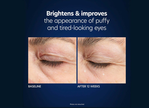 PCA Skin Microneedle Eye Patches - set of 4 - SkinElite - before and after 3