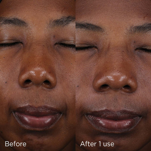 IMAGE DAILY PREVENTION pure mineral tinted moisturizer SPF 30 - 2.6 fl oz - SkinElite - before and after