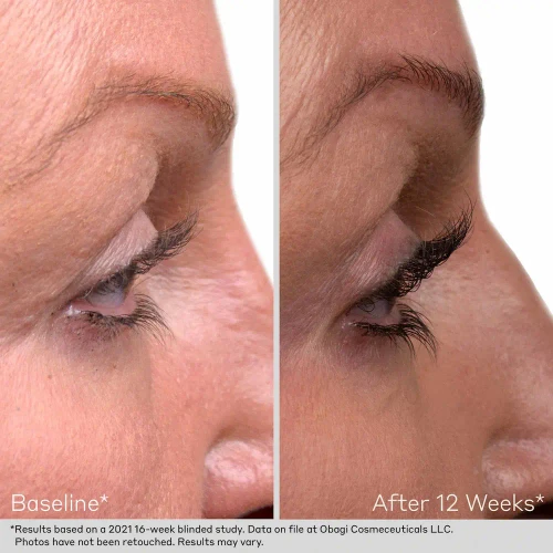 Obagi Lash and Brow Serum Set lash before and after