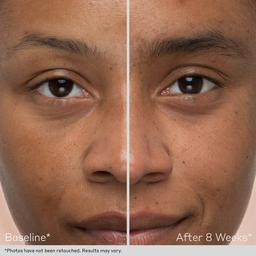 Obagi Lash and Brow Serum Set brow before and after