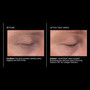 PCA Skin Ideal Complex Revitalizing Eye Gel 0.5fl oz - results