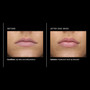 PCA Skin Hyaluronic Acid Lip Booster 0.24 oz - results