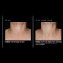 PCA Skin Perfecting Neck & Decollete 3 fl oz - results