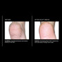 PCA Skin Body Therapy 7fl oz - results