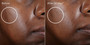 Murad Rapid Dark Spot Correcting Serum - SkinElite - before and after 3