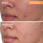 Murad Rapid Dark Spot Correcting Serum - before and after