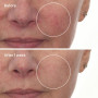 Murad Cellular Hydration Barrier Repair Serum - before and after