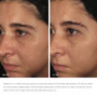 IMAGE Ormedic Balancing Biopeptide Crème 2 oz - SkinElite - before and after