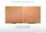 Glytone Resurfacing Body Oil 4 fl oz - SkinElite - before and after