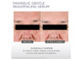 Glytone Mandelic Gentle Resurfacing Serum 1 fl oz - SkinElite - before and after