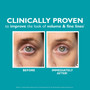 Peter Thomas Roth Peptide Skinjection Fill + Fix Under-Eye Cream 0.5 fl oz - SkinElite - before and after