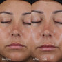 IMAGE DAILY PREVENTION ultra defense moisturizer SPF 50 - 2.6 fl oz - SkinElite - before and after