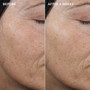 IMAGE AGELESS+ retinol pure liquid retinol 0.3% - SkinElite - before and after