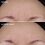 IMAGE Ageless+ Retinol Treatment Creme 1.2% retinol complex - SkinElite - before and after