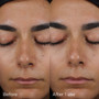 IMAGE DAILY PREVENTION sheer matte moisturizer SPF 30 - 2.6 fl oz - SkinElite - before and after