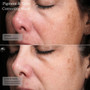 Senté Pigment & Tone Correcting Mask 1.7 fl oz - SkinElite - before and after 5