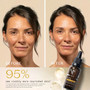 Yon-Ka Paris Serum Omega - Skin Elite - before and after