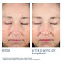 SkinBetter Science Mystro Revive Renewing Serum 1 fl oz - Skin Elite - Clinical Results SkinBetter Science Mystro Revive Renewing Serum 1 fl oz - Skin Elite - Clinical Results