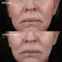 IMAGE MD Biotech Longevity Creme 1.7 fl oz before and after