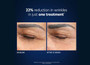 PCA Skin Microneedle Eye Patches - set of 4 - SkinElite - before and after 1