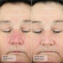 Senté Complete Repair System Kit before and after 2