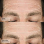 Senté Complete Repair System Kit before and after 1