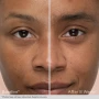 Obagi Lash and Brow Serum Set brow before and after