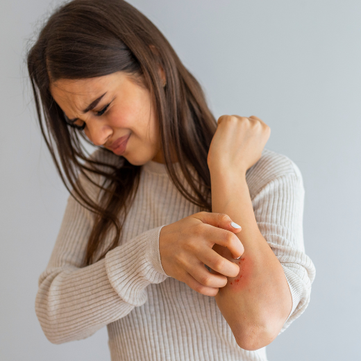 Living with Eczema: A Guide to Smoother Skin and a Calmer Mind
