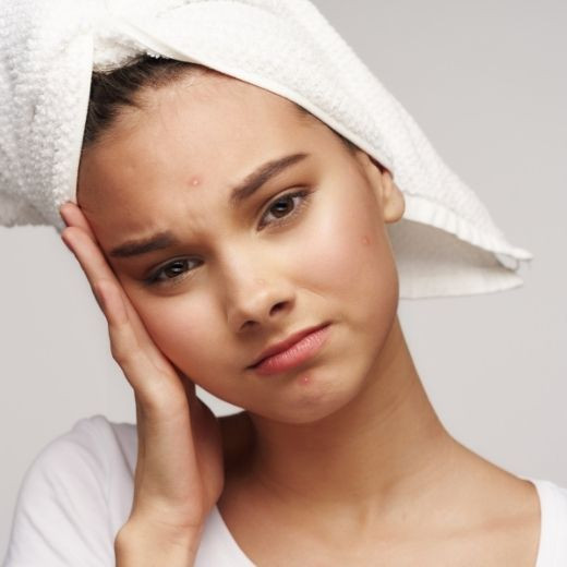 Surprising Ways You Can Get Acne