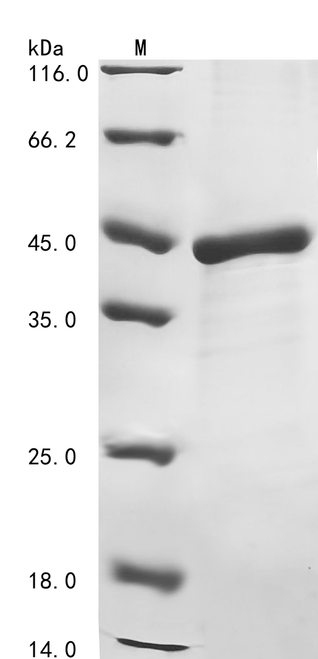 (Tris-Glycine gel) Discontinuous SDS-PAGE (reduced) with 5% enrichment gel and 15% separation gel. (Tris-Glycine gel) Discontinuous SDS-PAGE (reduced) with 5% enrichment gel and 15% separation gel.